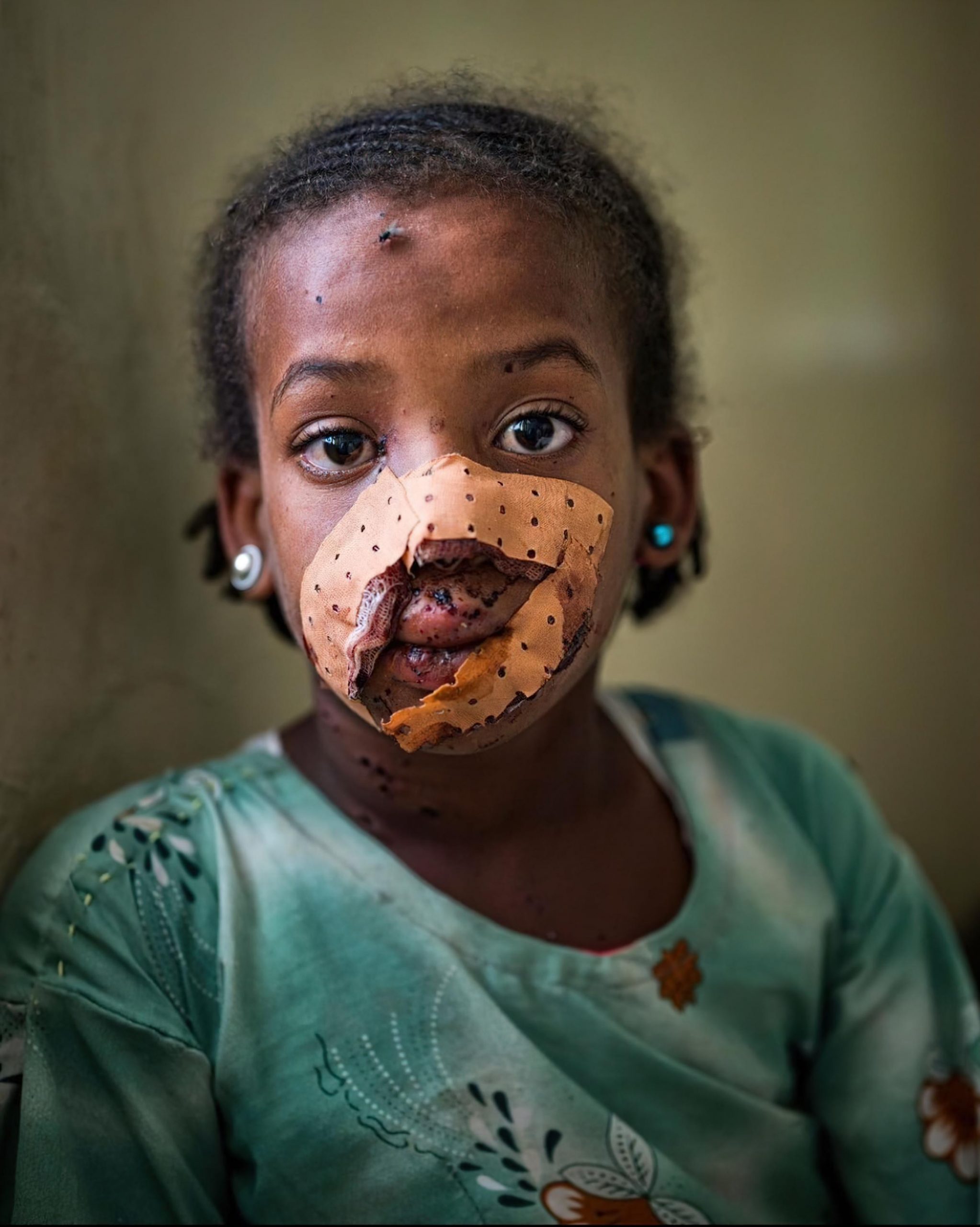 KILLING UNARMED ETHIOPIANS